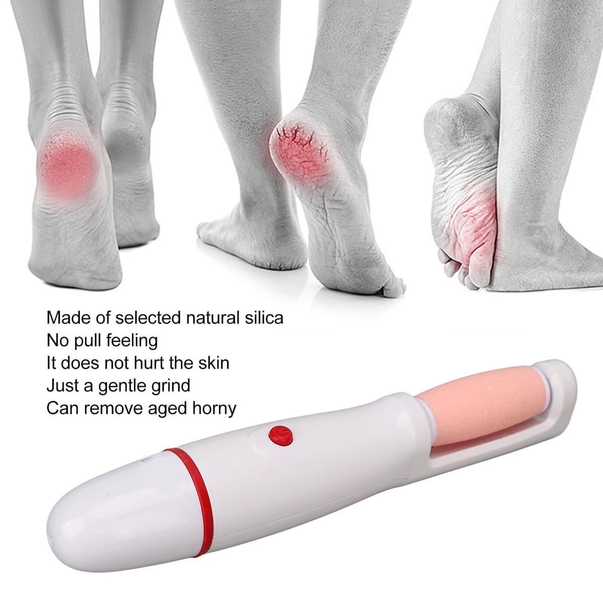 Râpe Électrique Anti-Callosités pour les Pieds